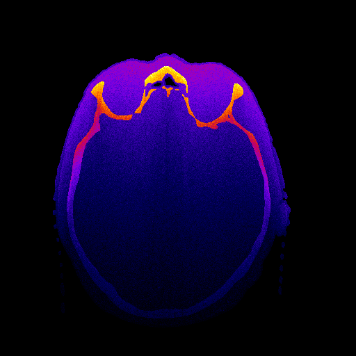 HeadDosimetry